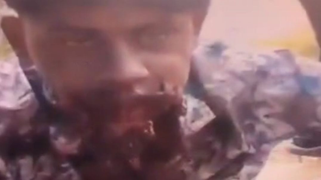 Indian man blows up his mouth with firecracker