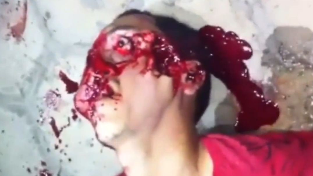 The last moment of dying man shot in the head