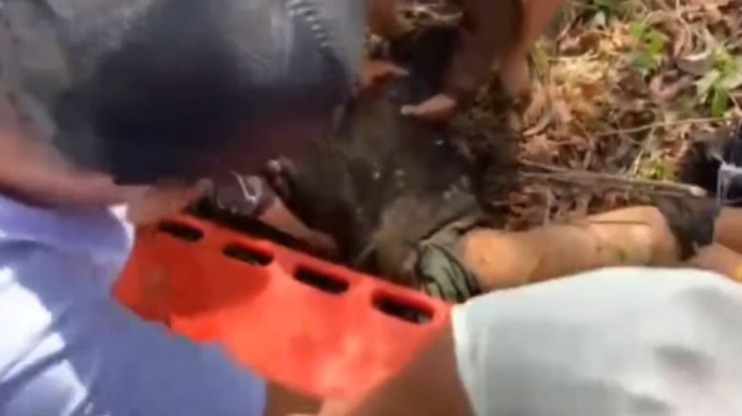 ⁣DUDE LOST MORE THAN A LEG